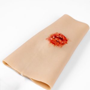 TraumaWear - Open Fracture Forearm