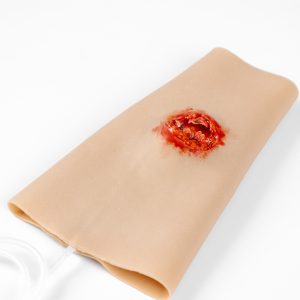 TraumaWear - Open Fracture Forearm with Bleeding capacity