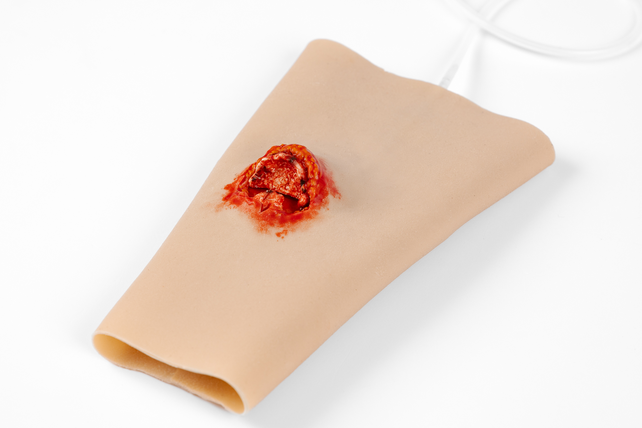 TraumaWear - Open Fracture Forearm with Bleeding capacity - Image 2