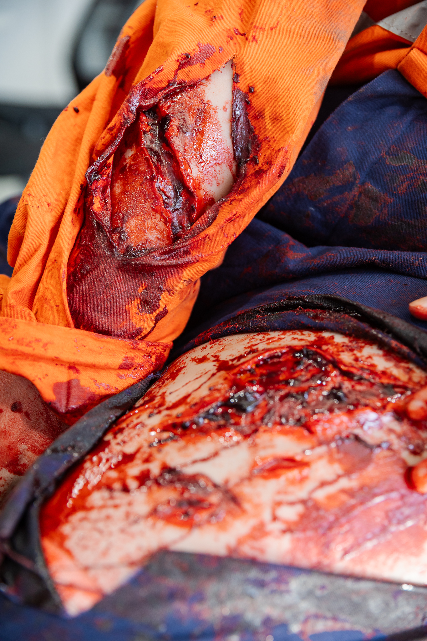 TraumaWear - Jagged Laceration Forearm with Bleeding Capacity - Image 14