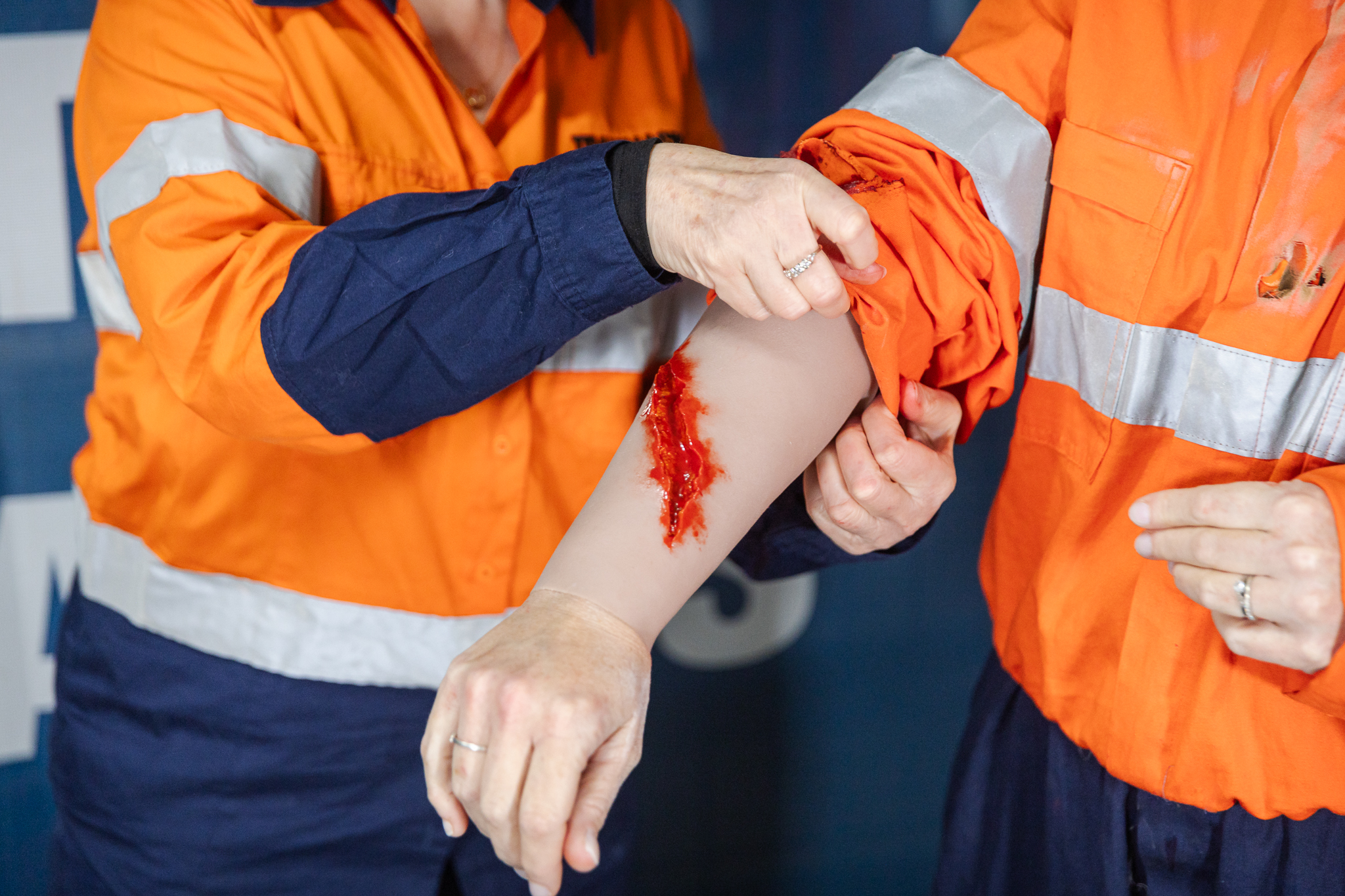 TraumaWear - Jagged Laceration Forearm - Image 6