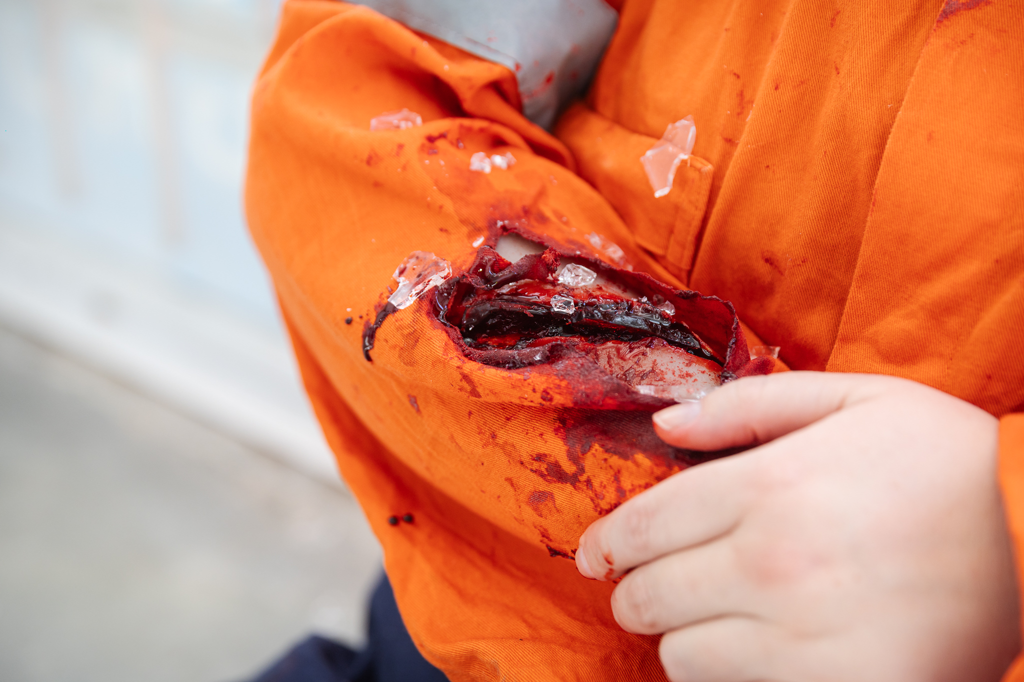 TraumaWear - Jagged Laceration Forearm - Image 12