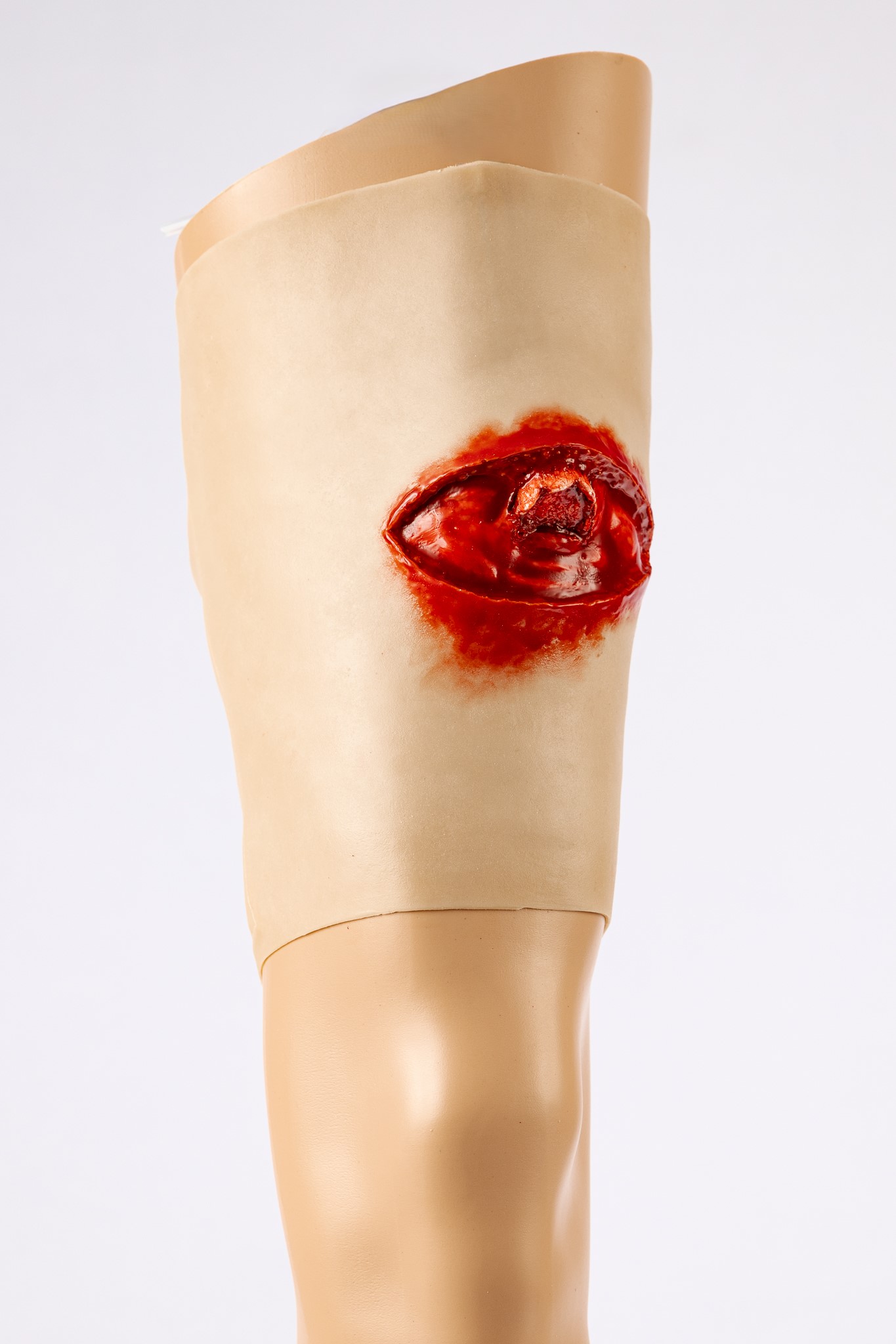 TraumaWear - Open Femur Fracture Upper Leg - Image 3