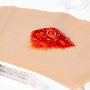 TraumaWear - Open Femur Fracture Upper Leg with Bleeding Capacity