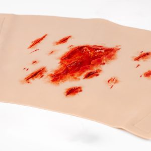 TraumaWear - Severe Lacerations Upper Leg