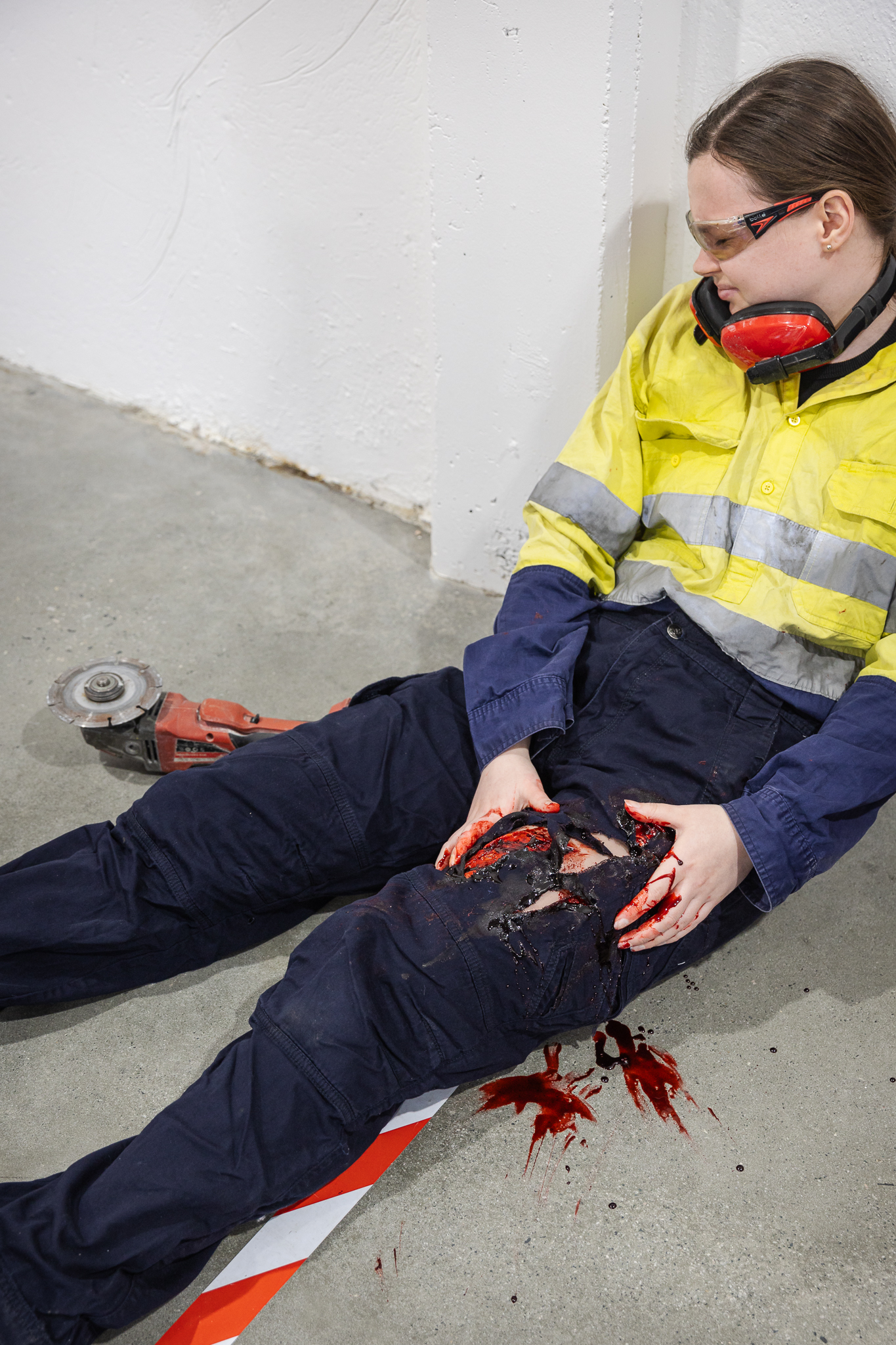 TraumaWear - Severe Lacerations Upper Leg - Image 11