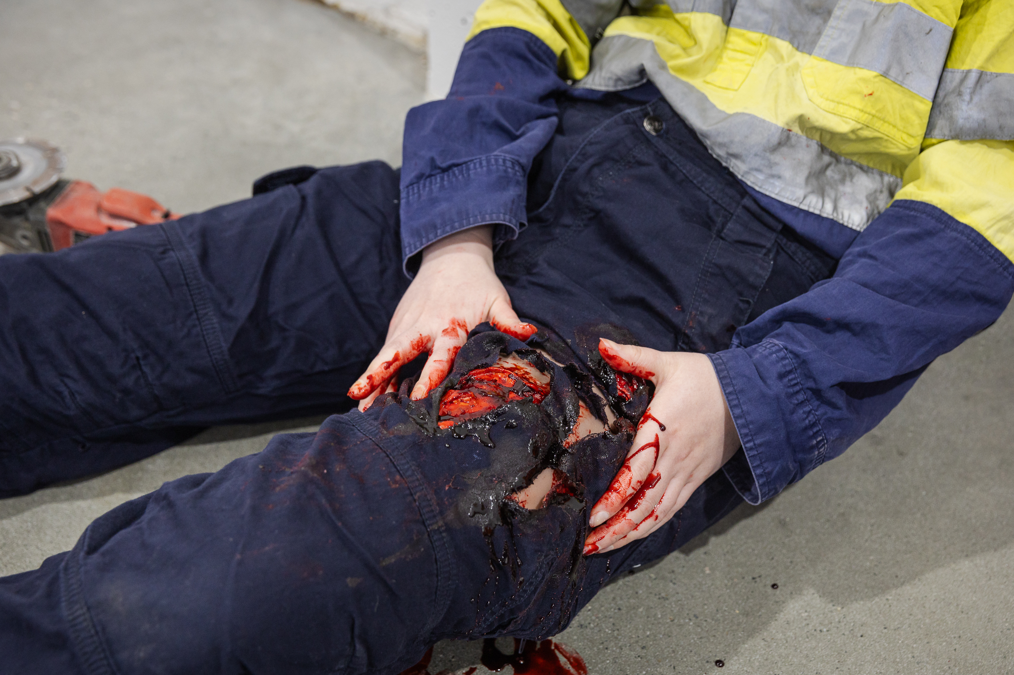 TraumaWear - Severe Lacerations Upper Leg - Image 12