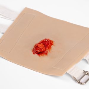 TraumaWear - Open Humerus Fracture Upper Arm