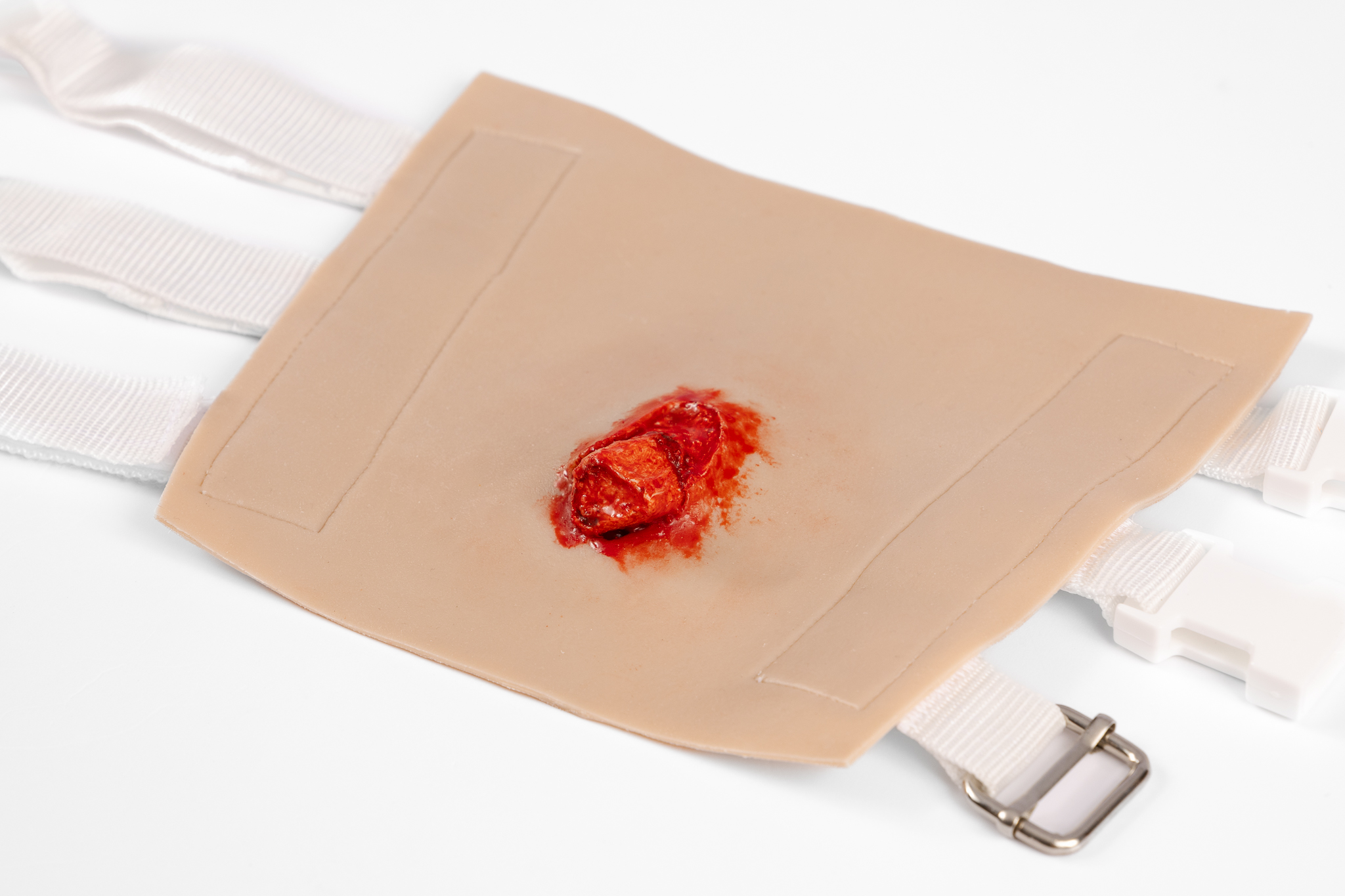 TraumaWear - Open Humerus Fracture Upper Arm