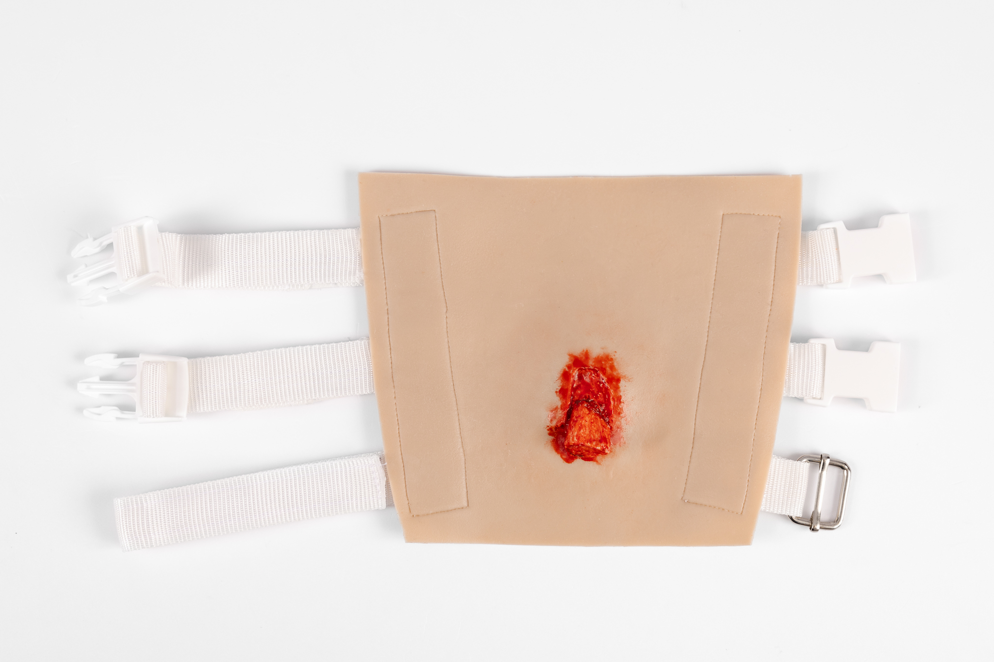 TraumaWear - Open Humerus Fracture Upper Arm - Image 2