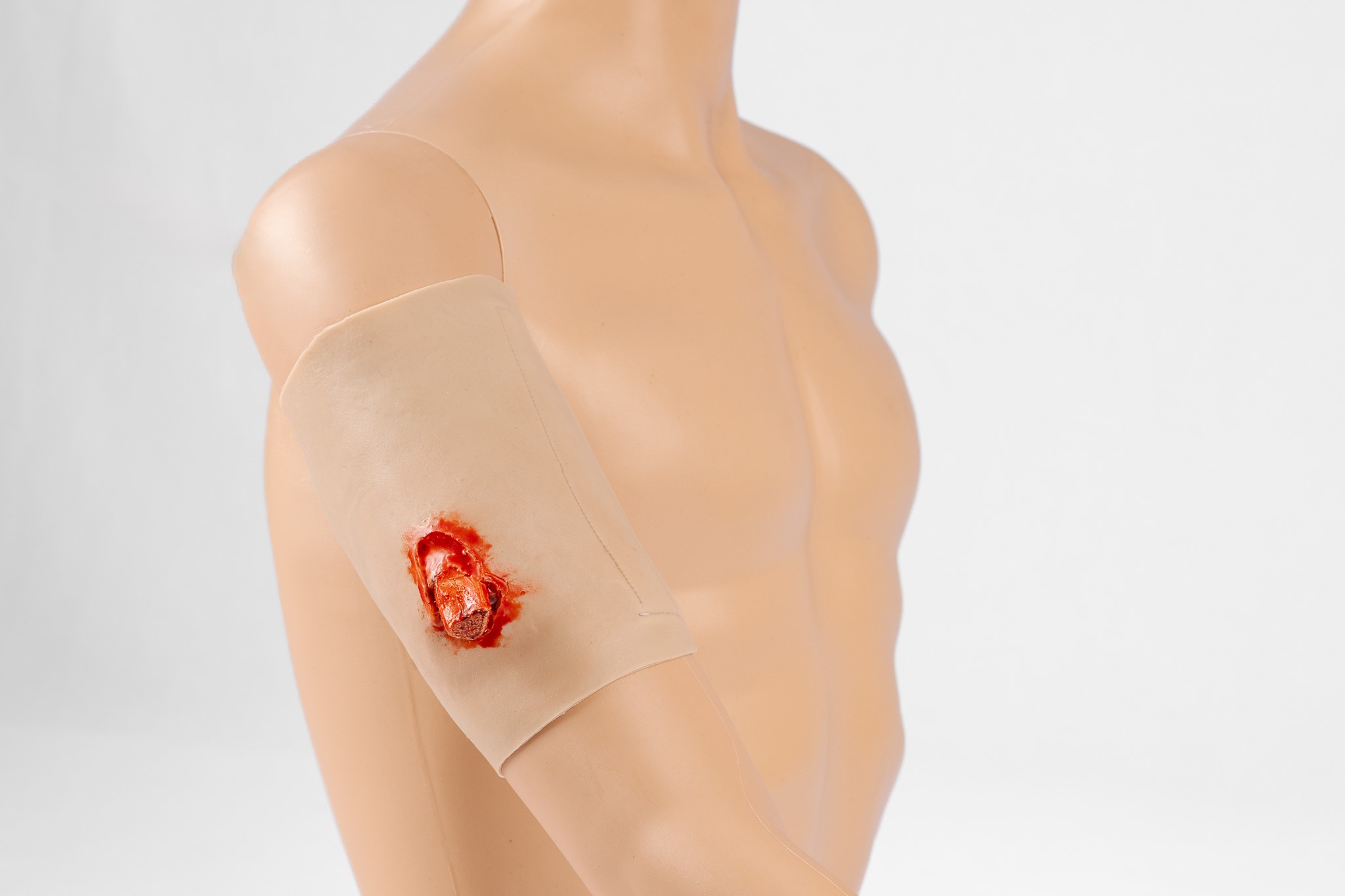 TraumaWear - Open Humerus Fracture Upper Arm - Image 3
