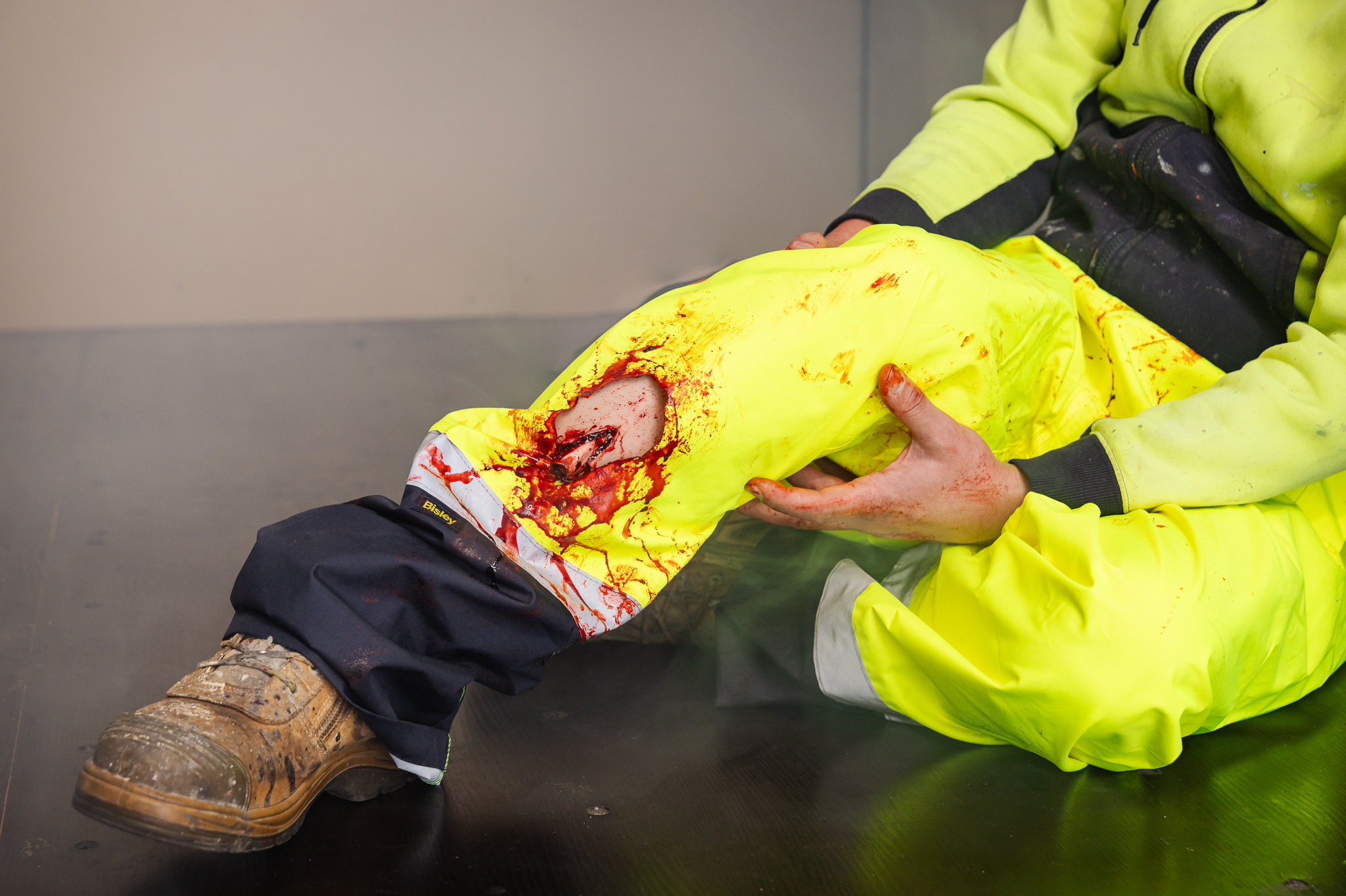 TraumaWear - Open Tibial Fracture Lower Leg - Image 14