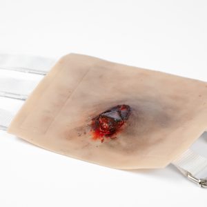 Combat TraumaWear - Open Humerus Fracture