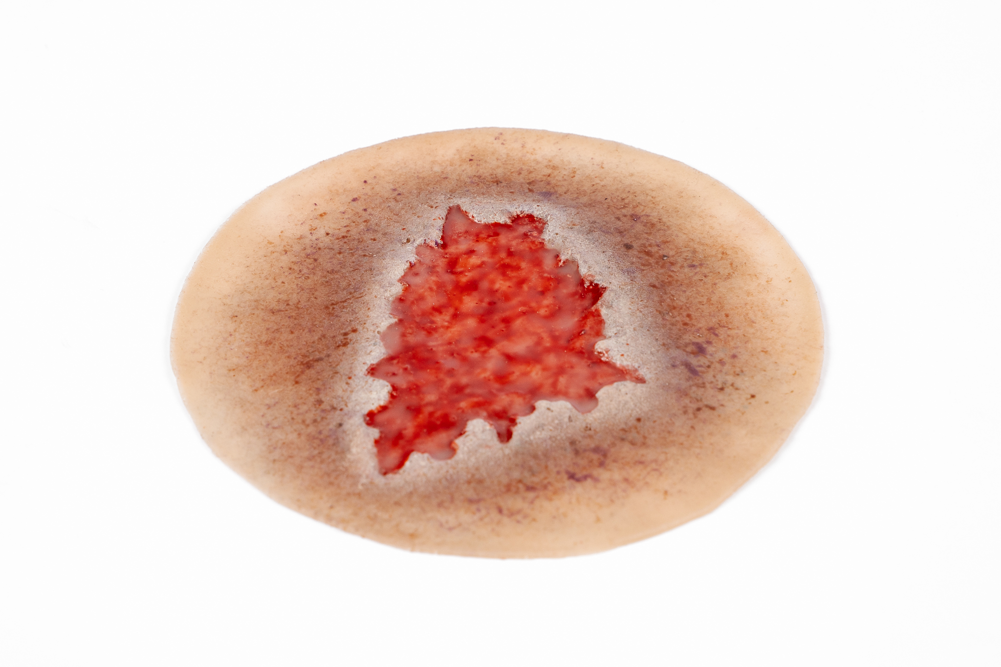 Clinical Ulcer Range - Image 5