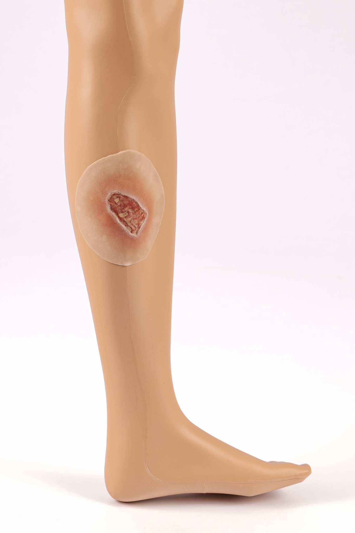 Silicone Wound Kit - Clinical - Image 29