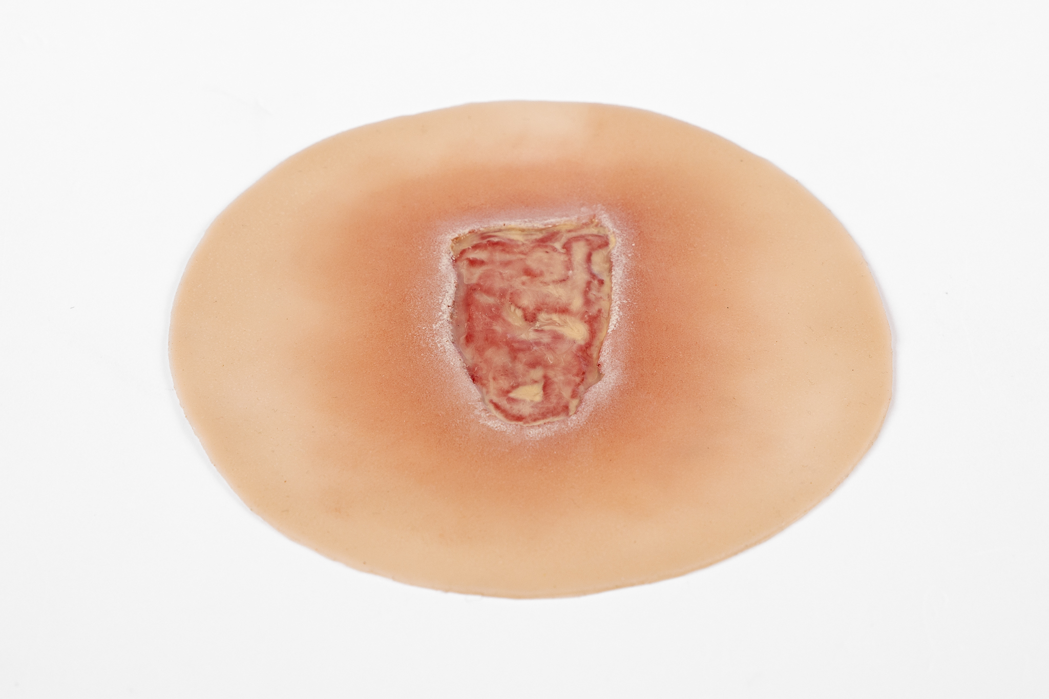 Clinical Ulcer Range - Image 7