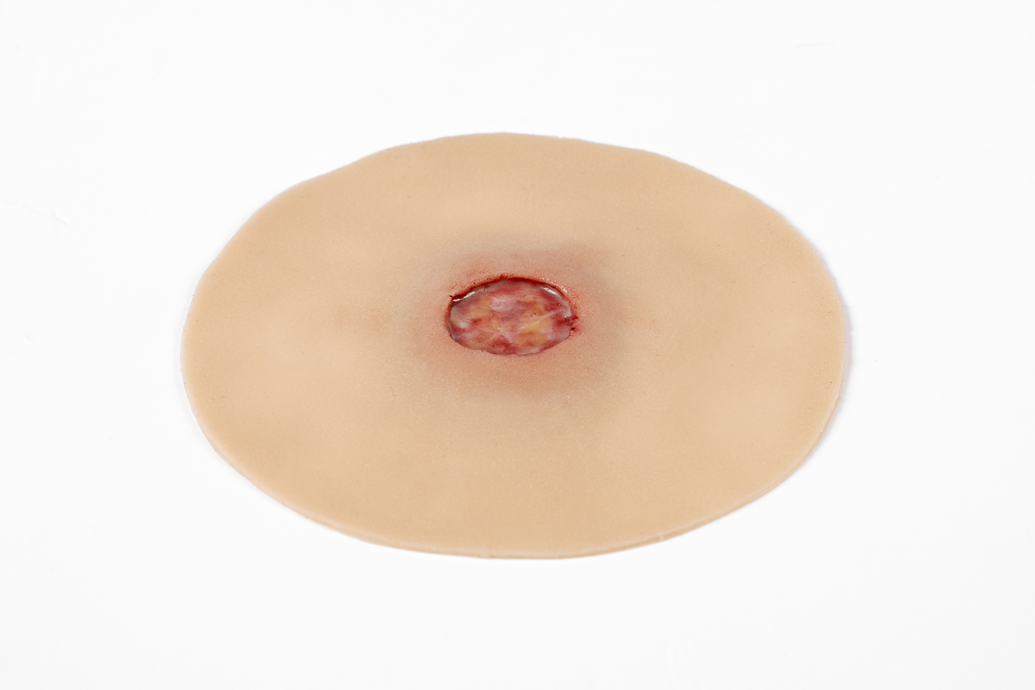 Clinical Ulcer Range - Image 3