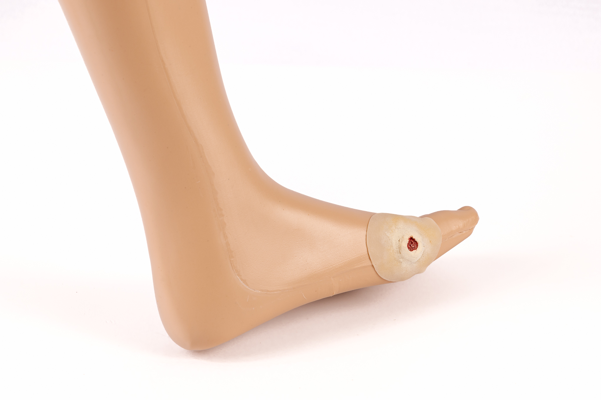 Clinical Ulcer Range - Image 8