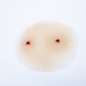 Gunshot Wound 5.56mm Entry Multi