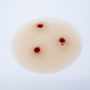 Gunshot Wound 7.62mm Entry Multi
