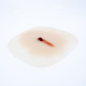 Gunshot Tracking Entry Wound