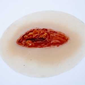 Laceration Open Fat Layer Small