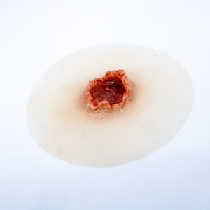 Laceration Circular