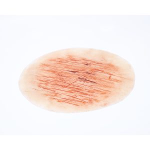 Abrasion Large Graze