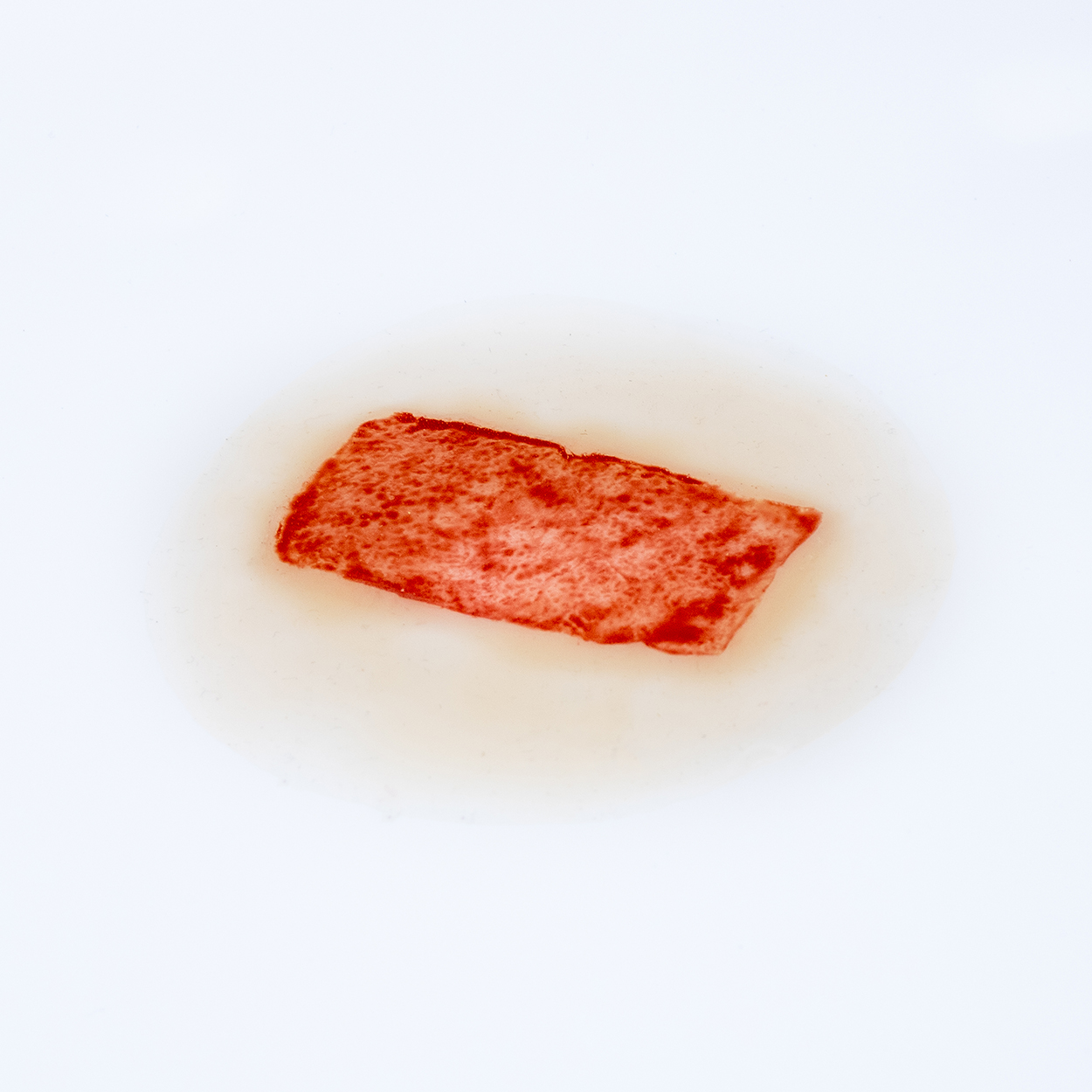 Skin Graft Donor Site - Image 5