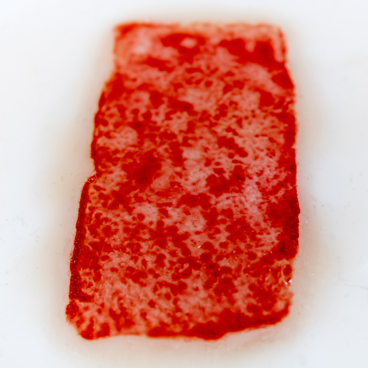 Skin Graft Donor Site - Image 2
