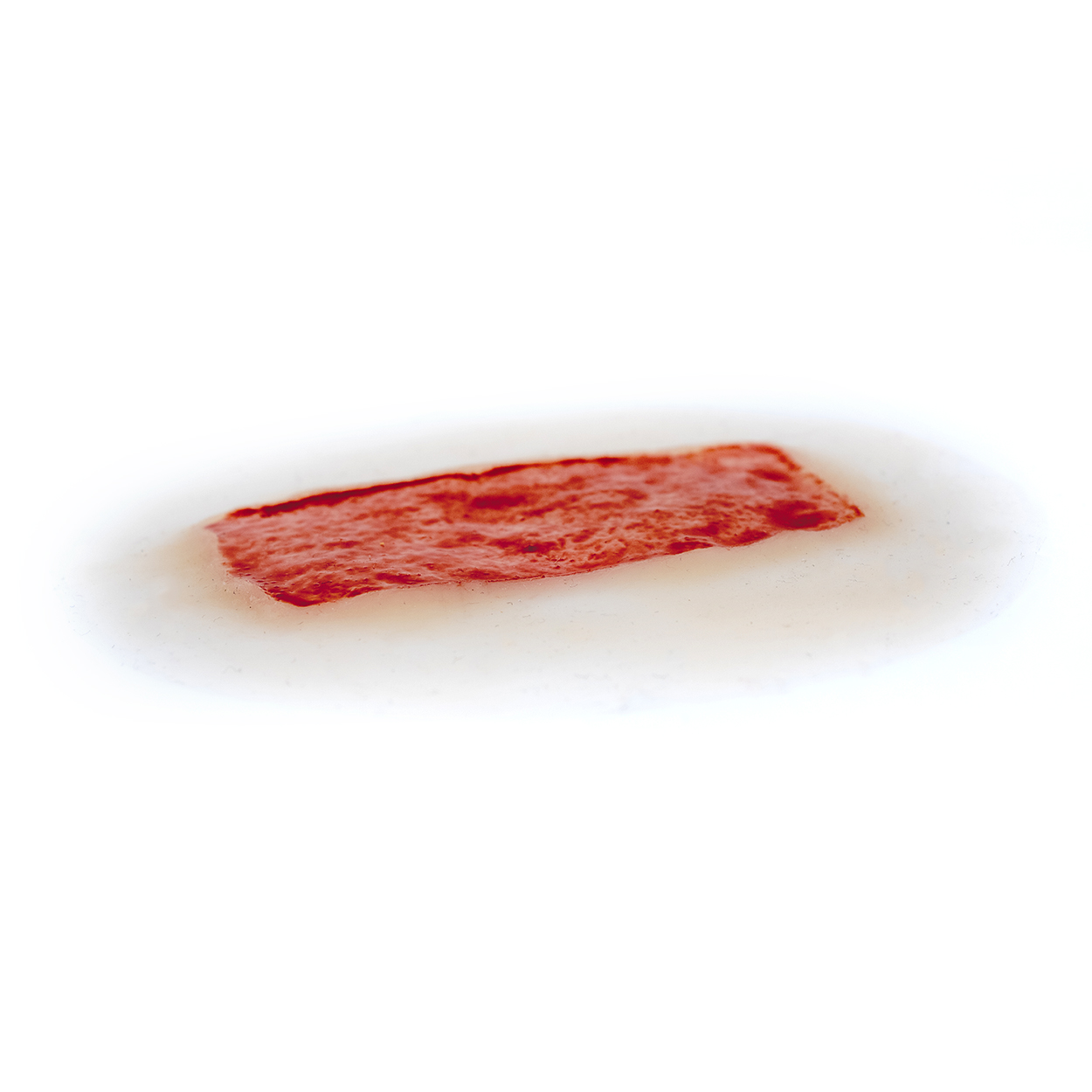 Skin Graft Donor Site - Image 3