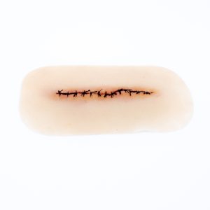 Suture Line Healing