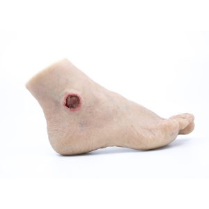 Lifecast Elderly Foot with Chronic Wounds