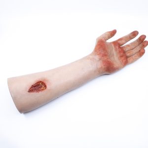 Arm with Bloody Wounds