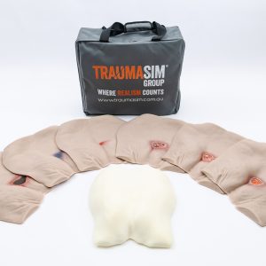 Pressure Injury Buttock Overlay Range