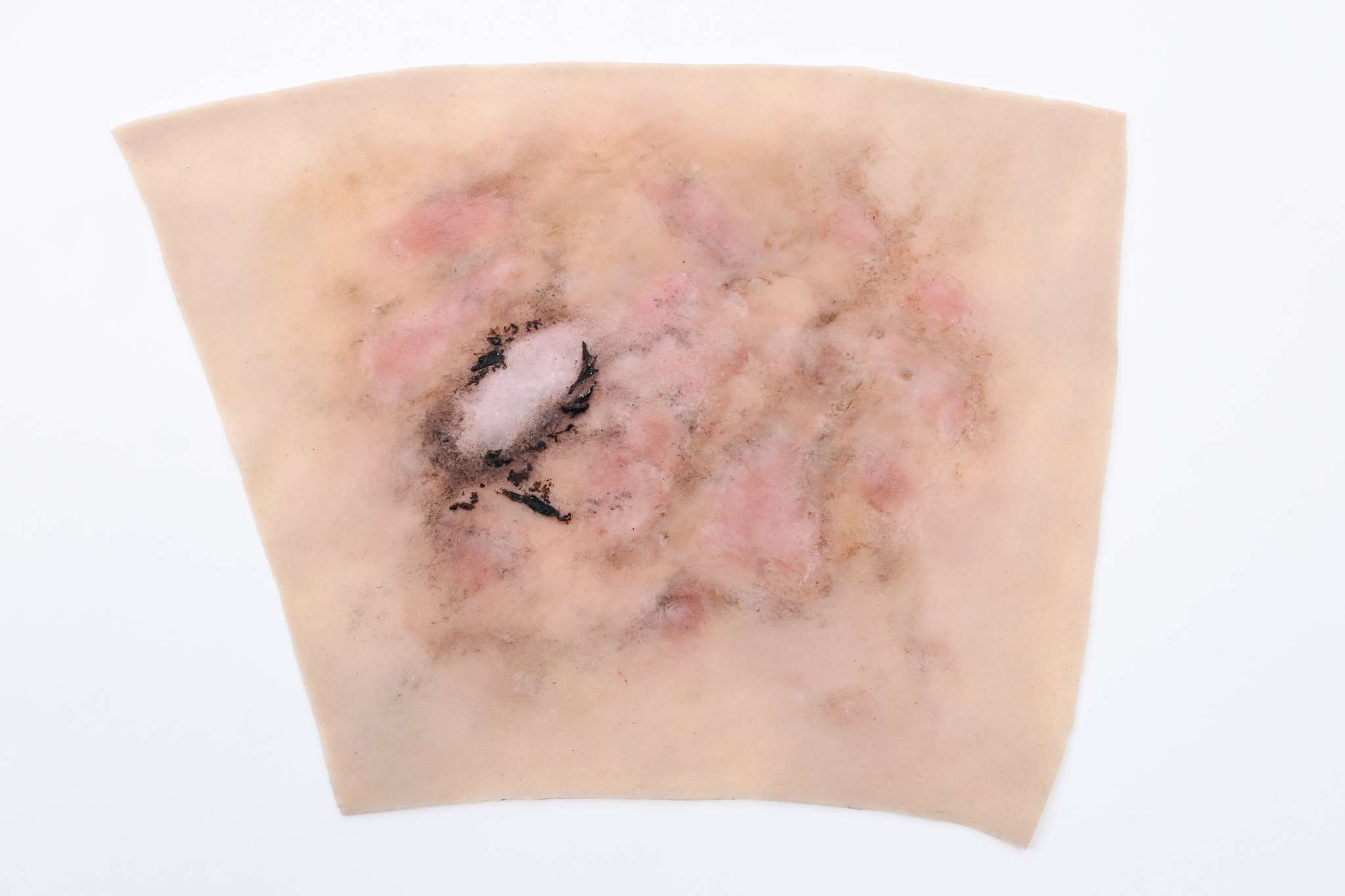 Forearm TraumaWear Fire Burn Set - Image 16