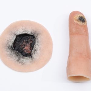 Electrical Burn Set