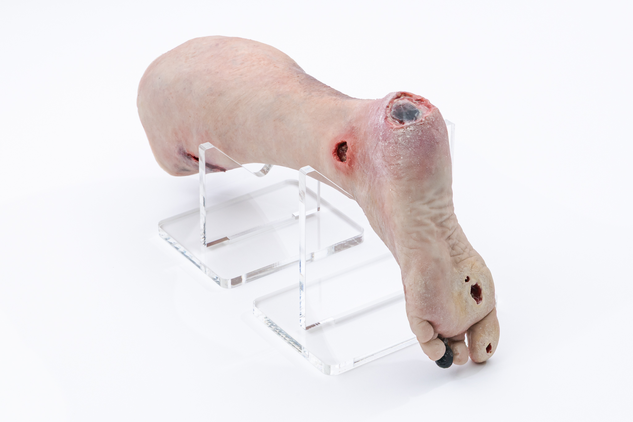Lifecast Elderly Leg with Chronic Wounds - Image 2