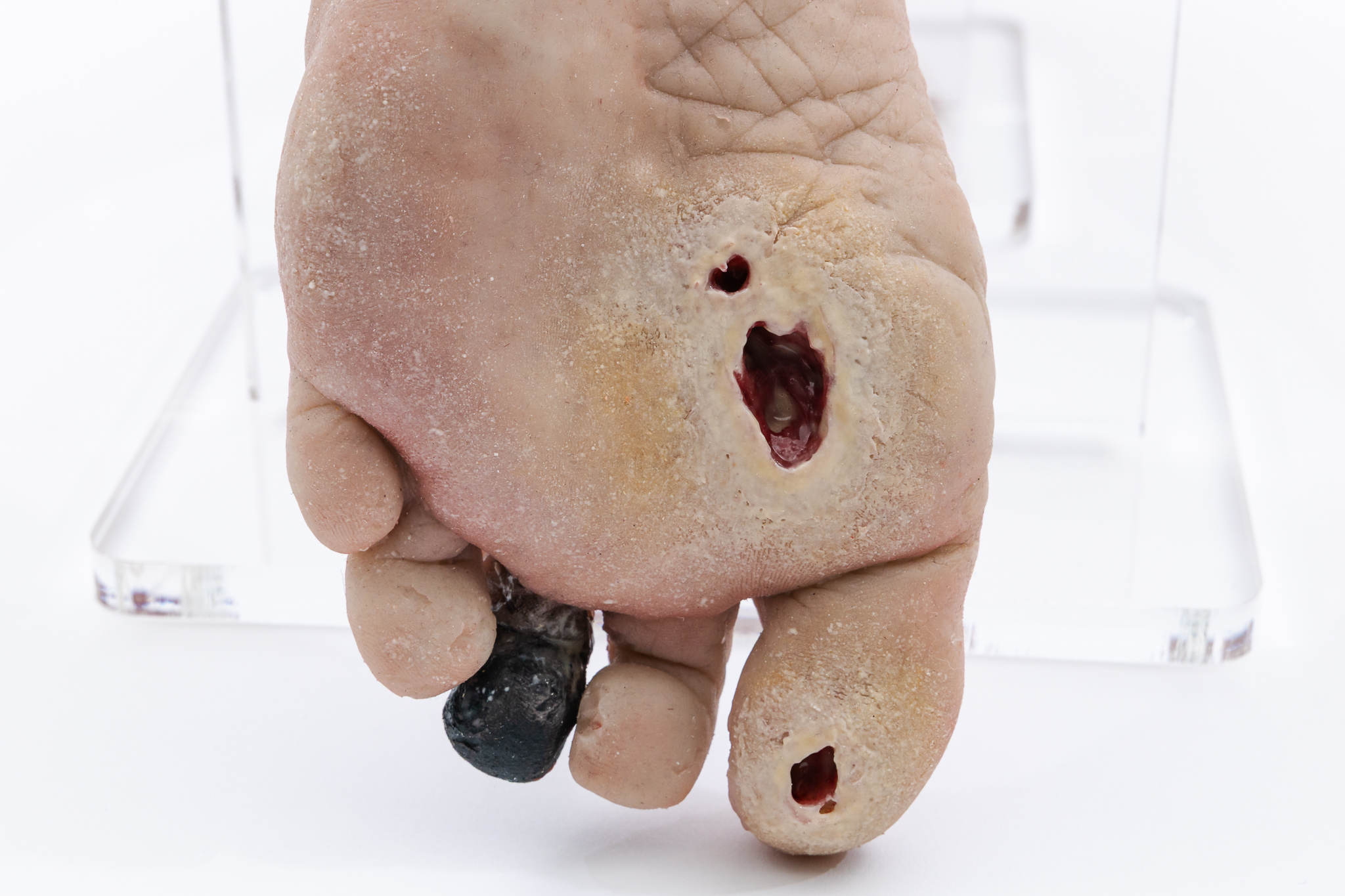 Lifecast Elderly Leg with Chronic Wounds - Image 4