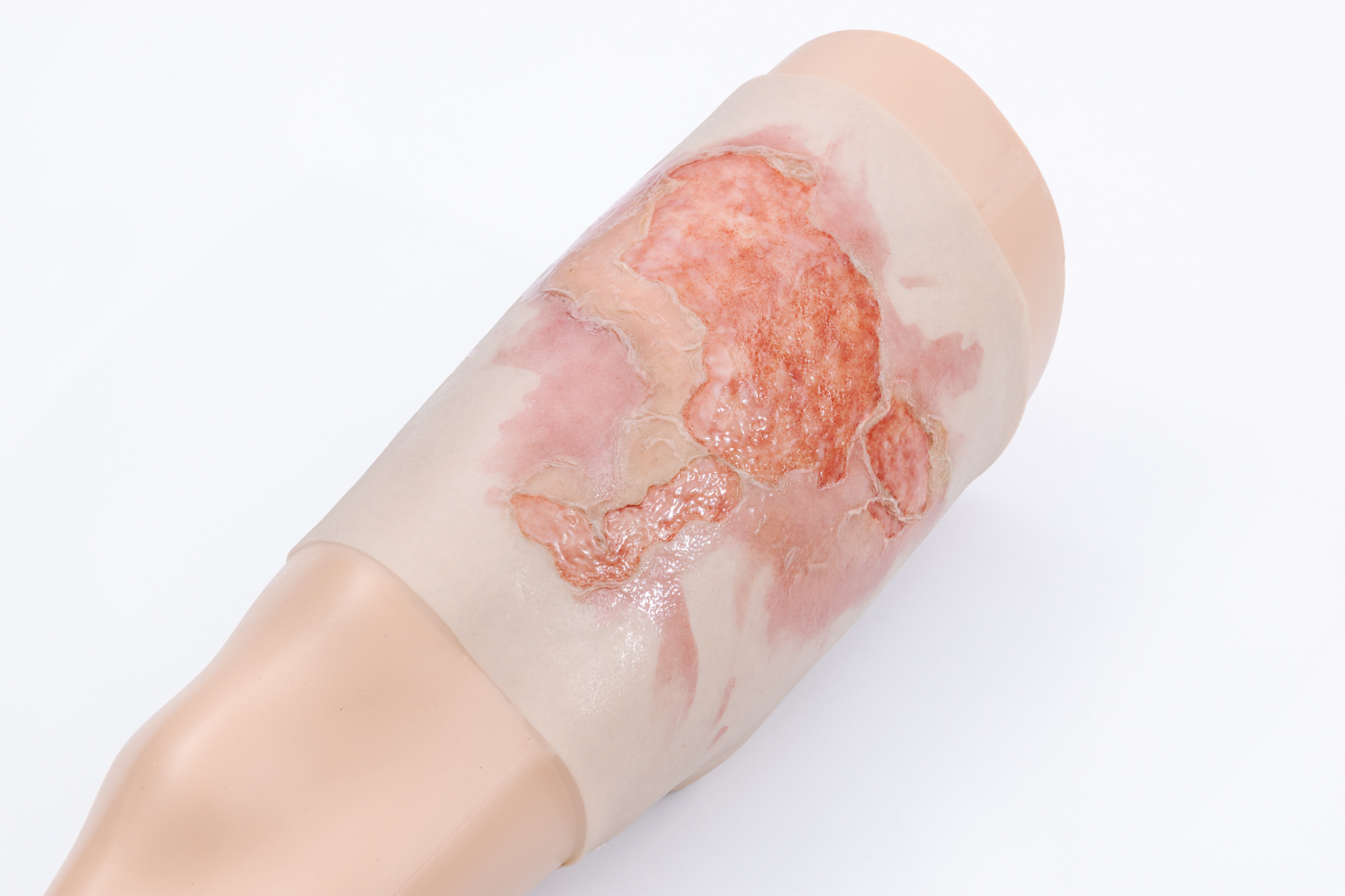Thigh TraumaWear Scalding Burn Set - Image 3
