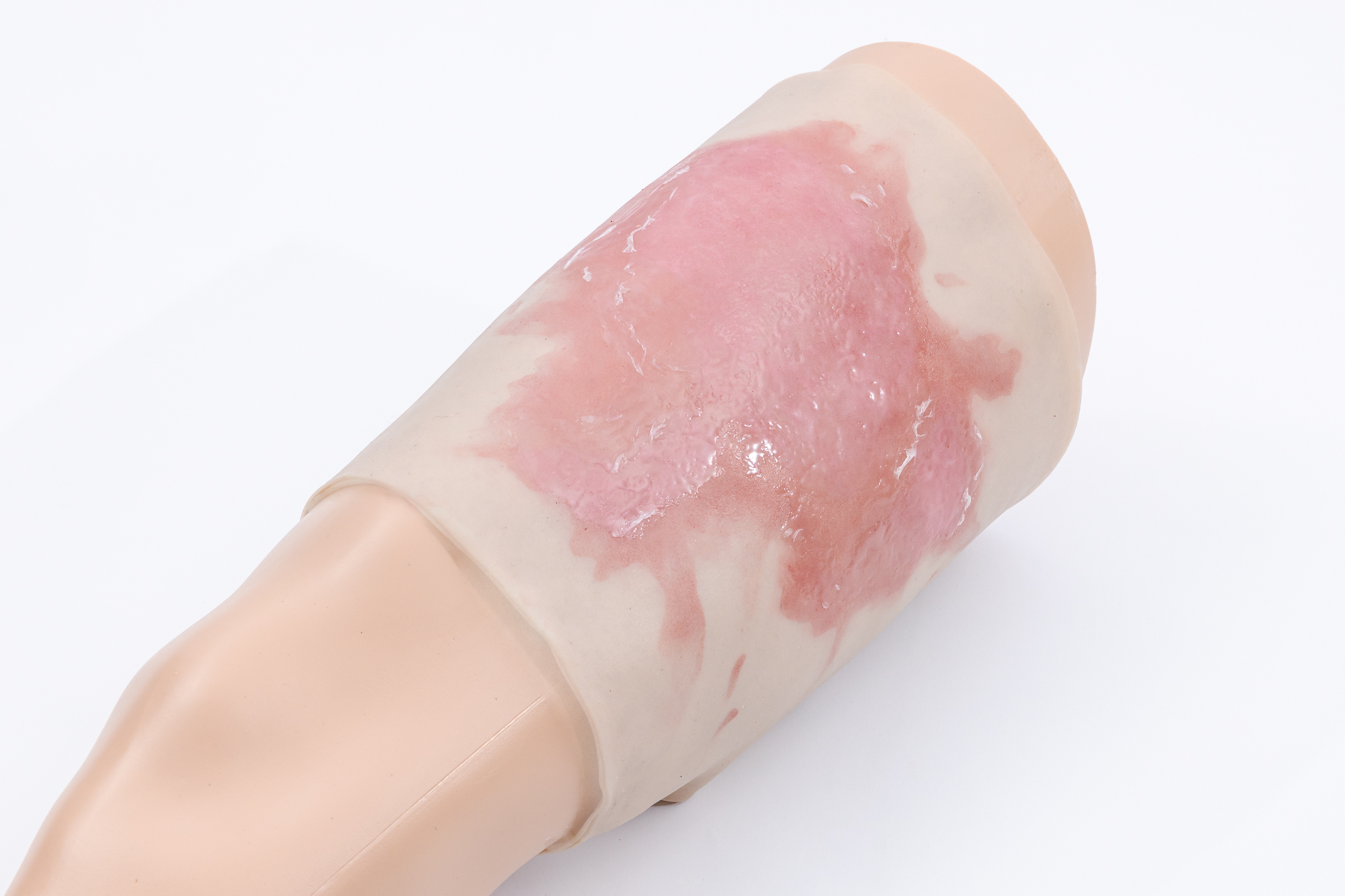 Thigh TraumaWear Scalding Burn Set - Image 2