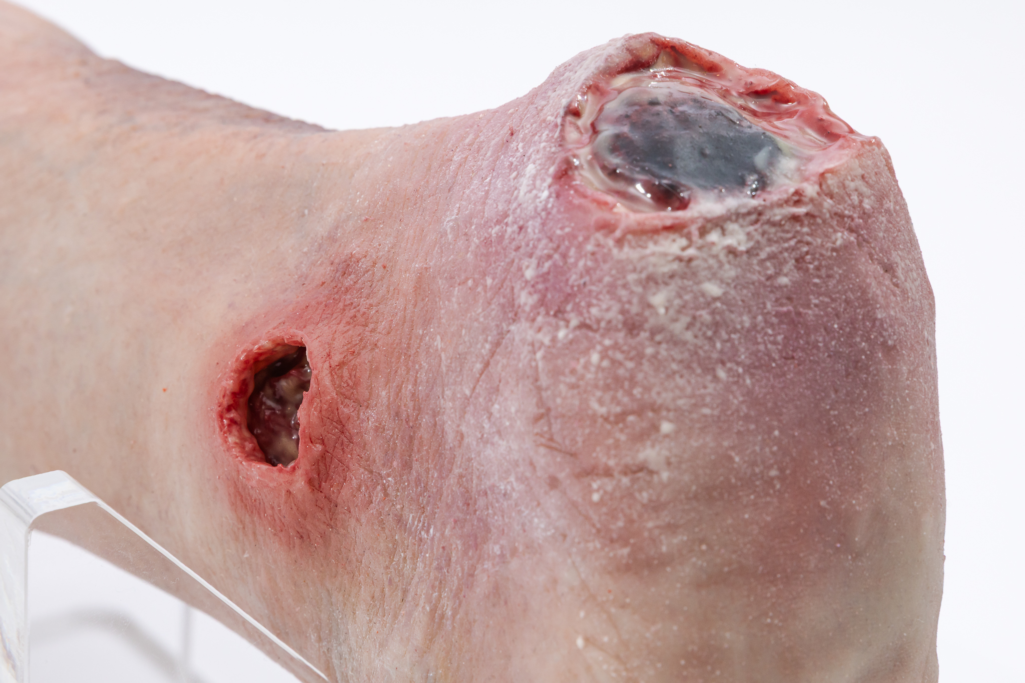 Lifecast Elderly Leg with Chronic Wounds - Image 5