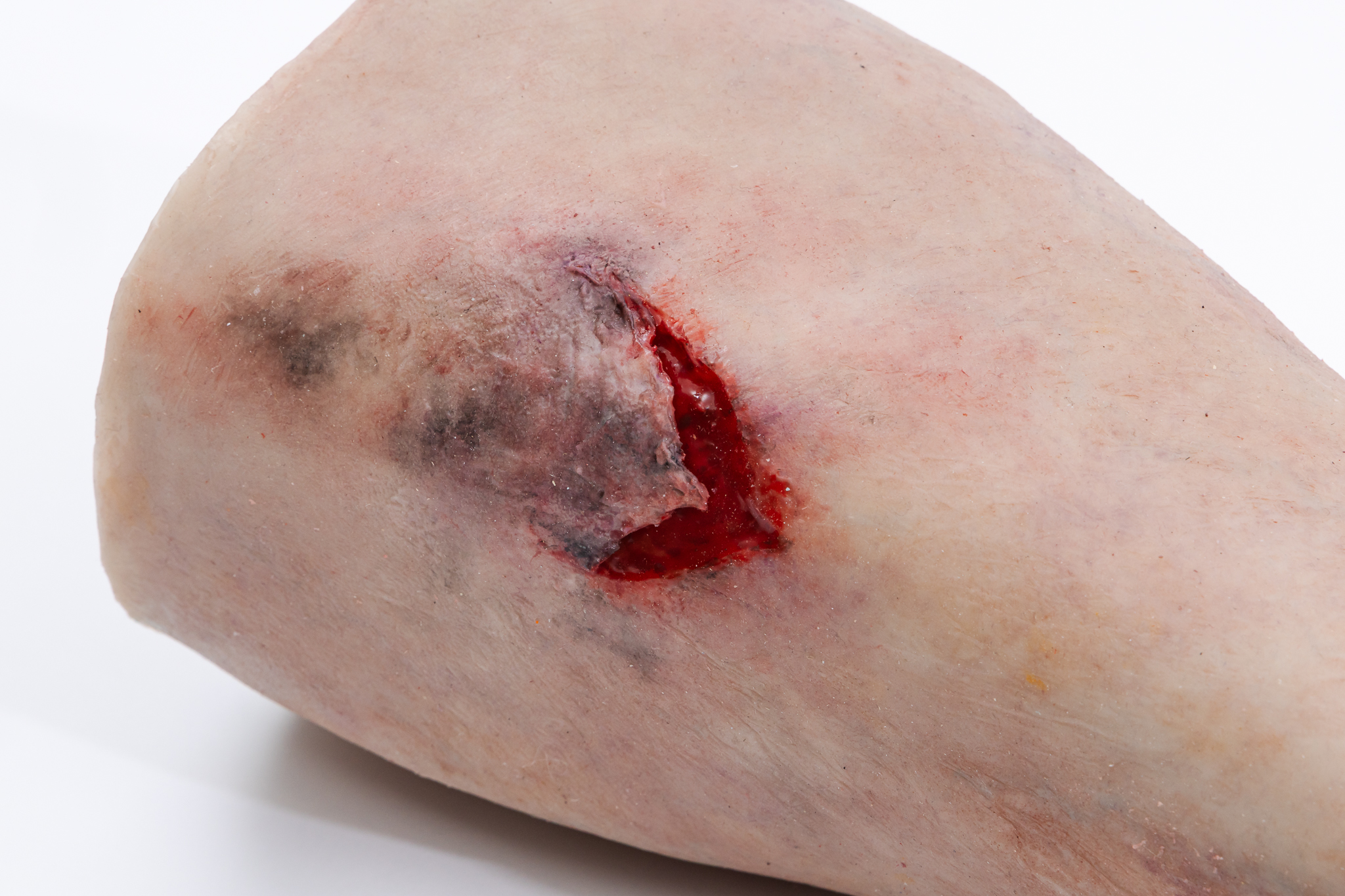 Lifecast Elderly Leg with Chronic Wounds - Image 10