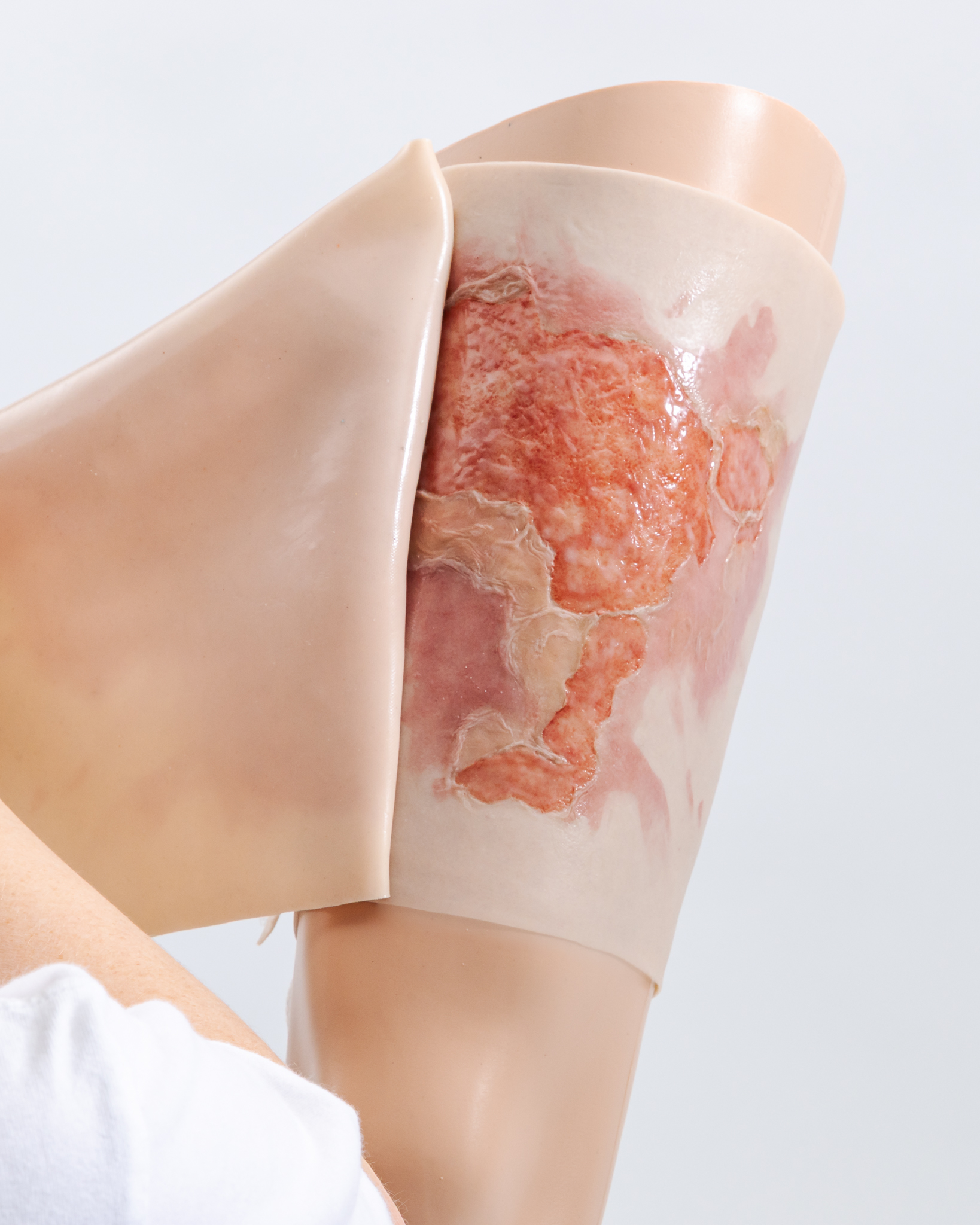 Thigh TraumaWear Scalding Burn Set - Image 11