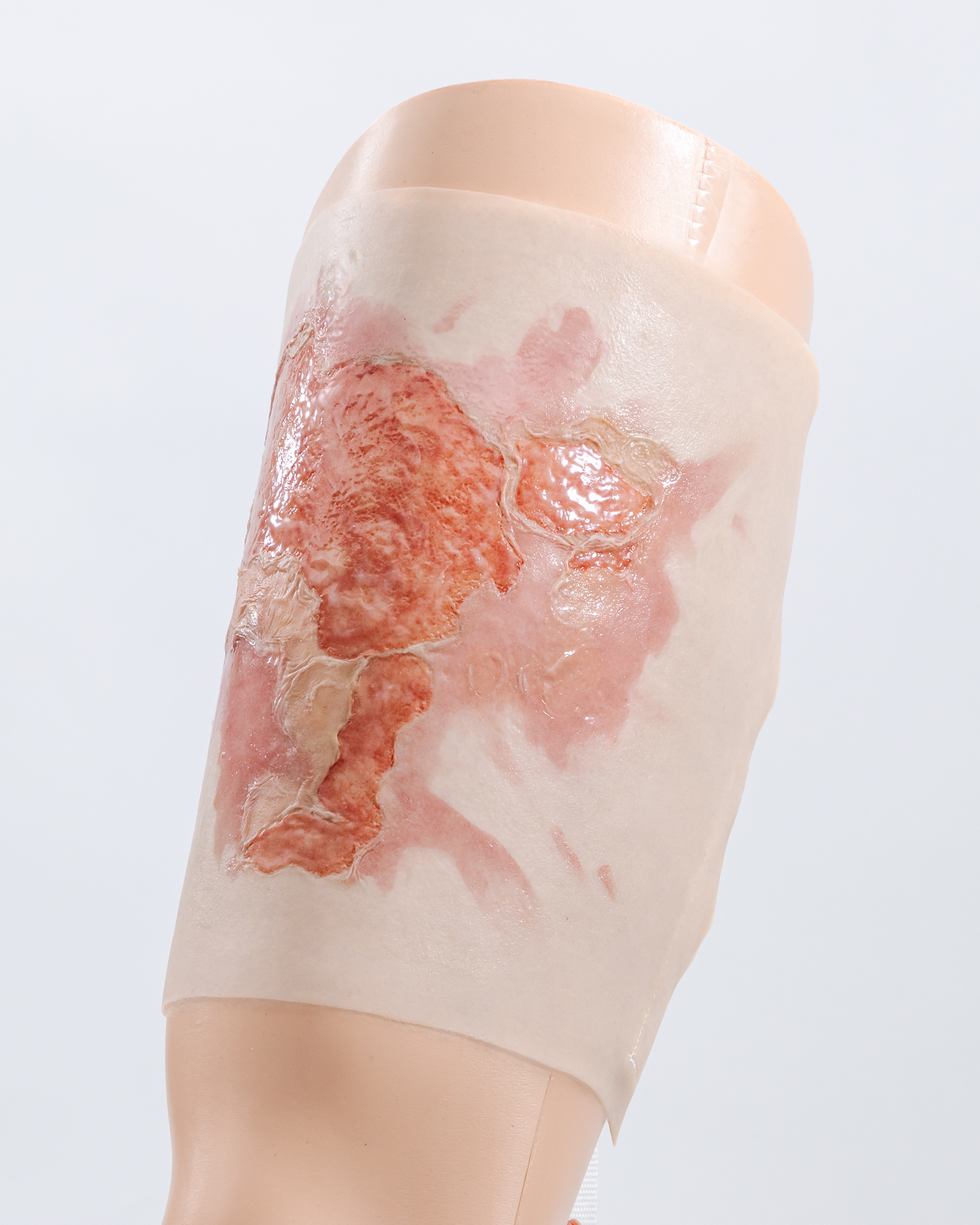 Thigh TraumaWear Scalding Burn Set - Image 12