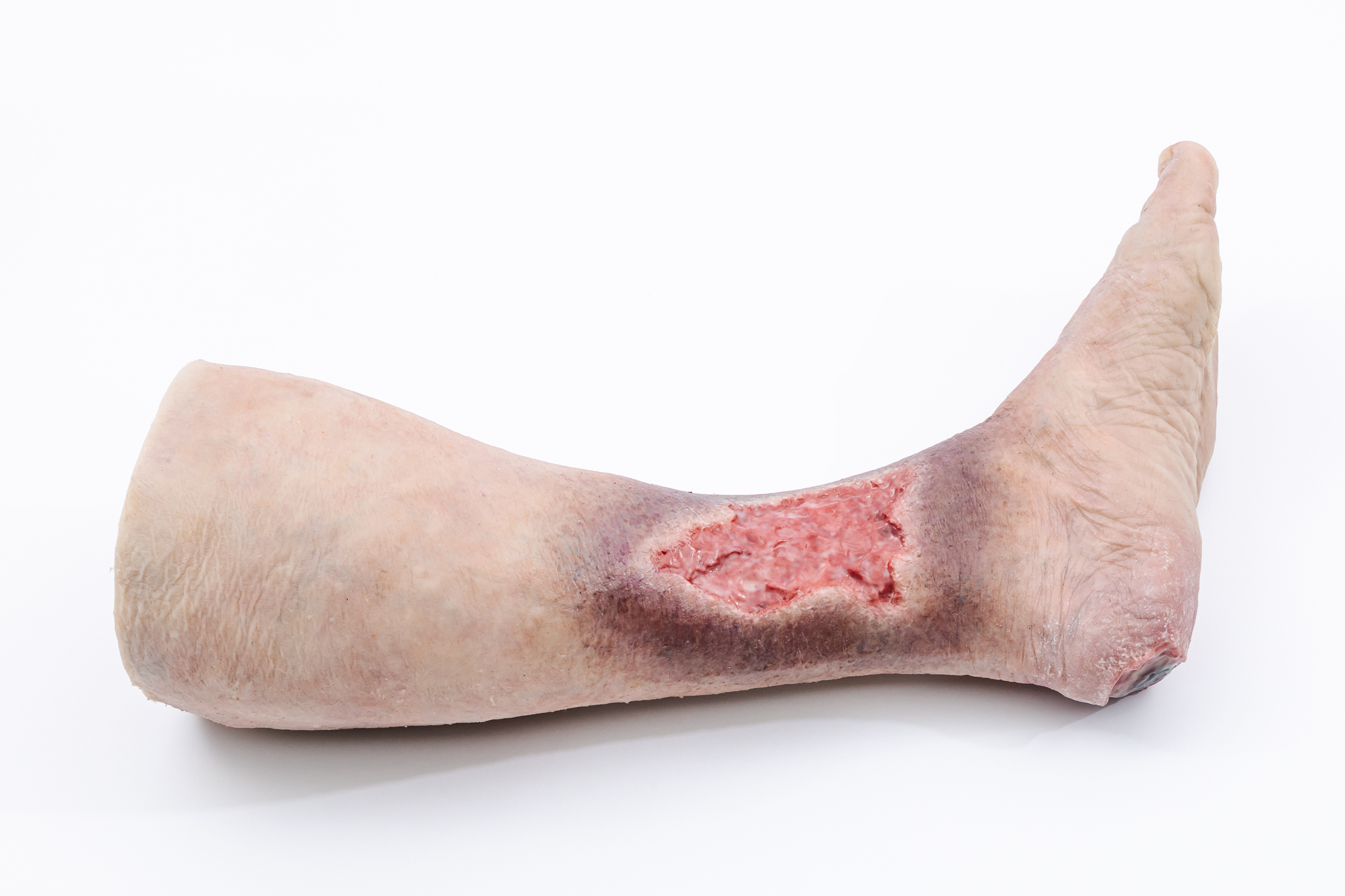 Lifecast Elderly Leg with Chronic Wounds - Image 7