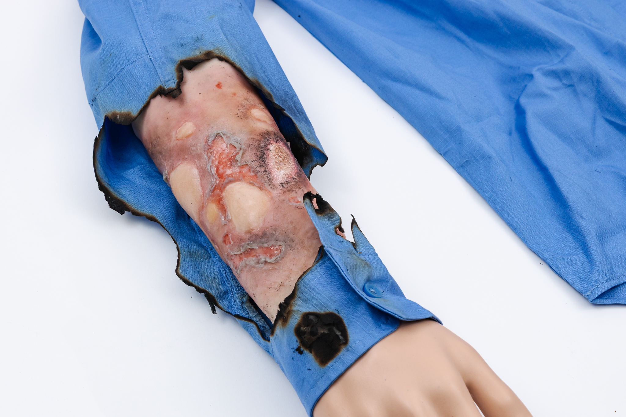 Forearm TraumaWear Fire Burn Set - Image 3