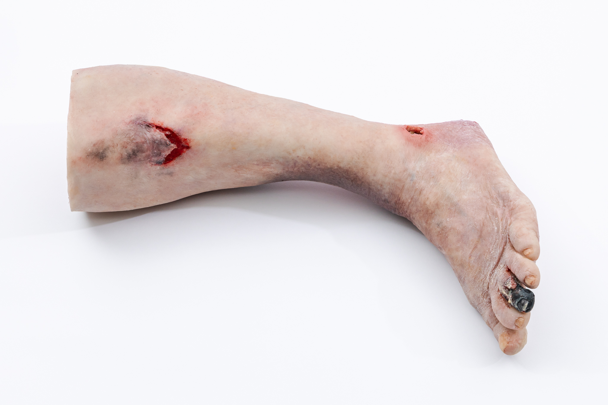 Lifecast Elderly Leg with Chronic Wounds - Image 11