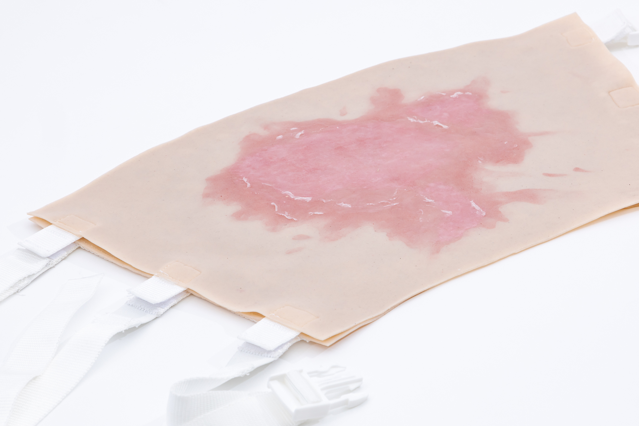 Thigh TraumaWear Scalding Burn Set - Image 4