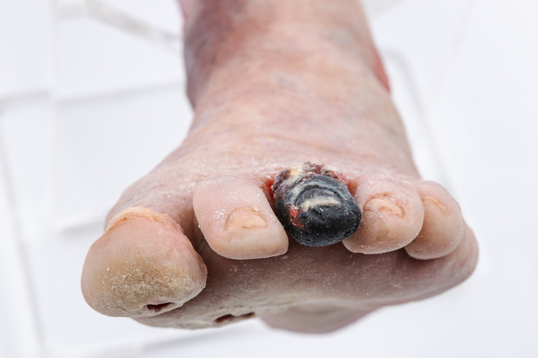 Lifecast Elderly Leg with Chronic Wounds - Image 9